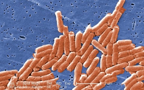 Salmonella, 117 casi nelle scuole della Val Trompia