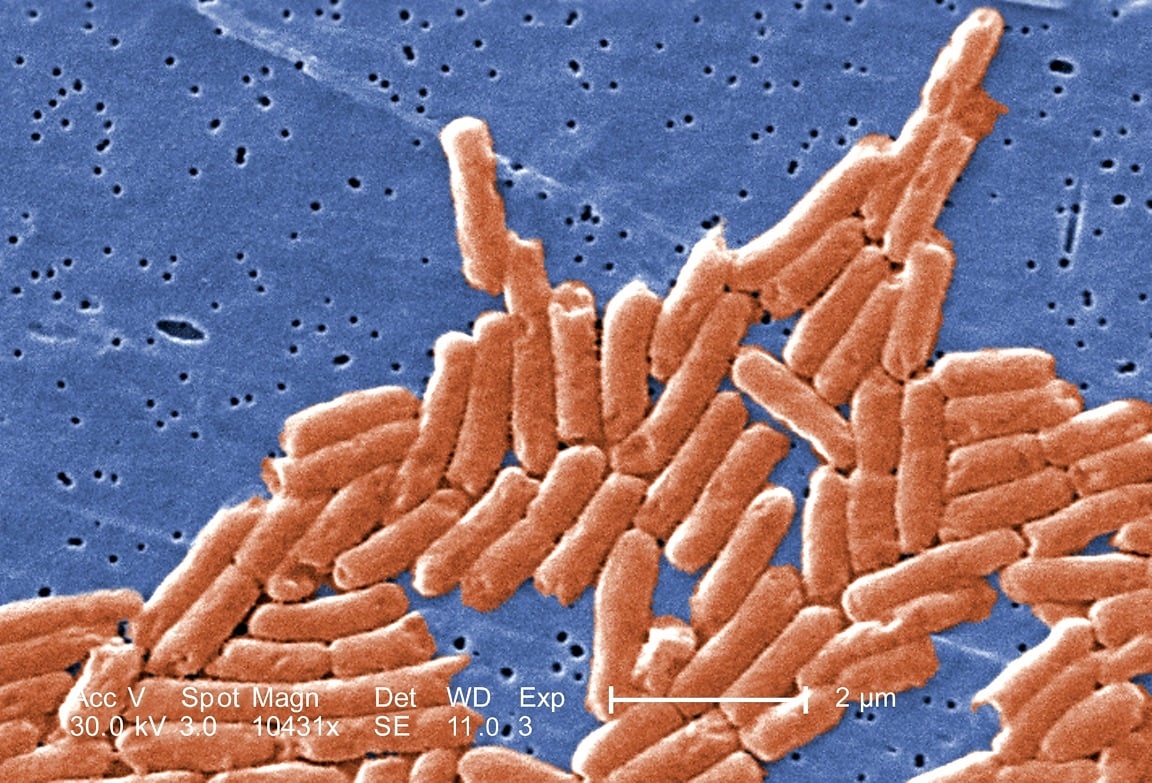 Salmonella, 117 casi nelle scuole della Val Trompia
